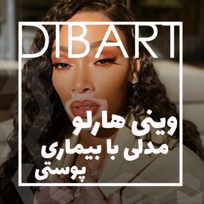 وینی هارلو